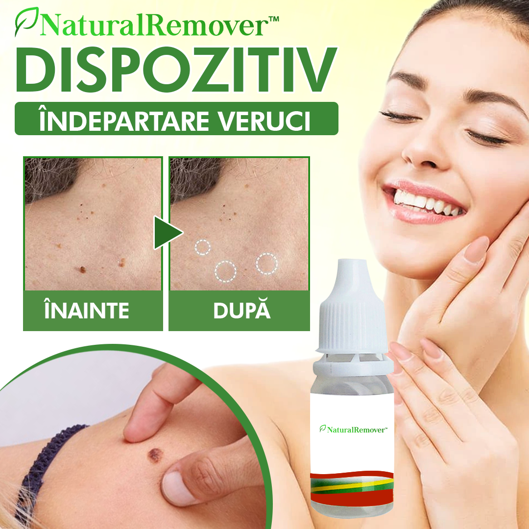 NaturalRemover™ Dispozitiv Îndepartare Veruci