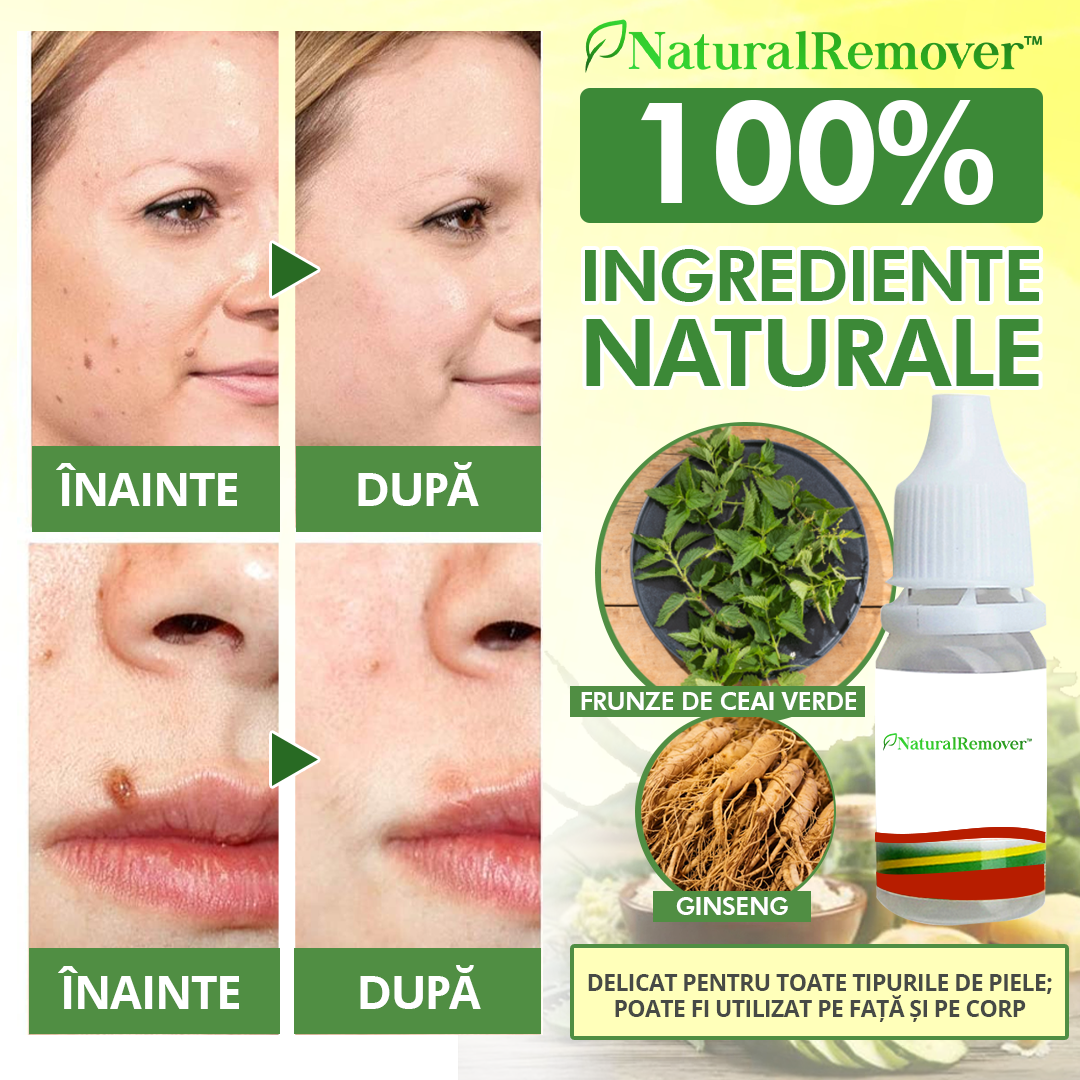 NaturalRemover™ Dispozitiv Îndepartare Veruci