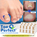 ToePerfect™ Corector Degete Picioare